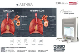 iBreathe®️, a portable device for testing lung function